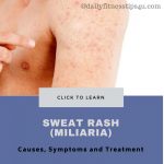 Sweat Rash (Miliaria)