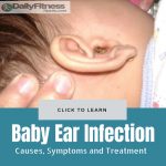 Baby Ear Infection causes treatment