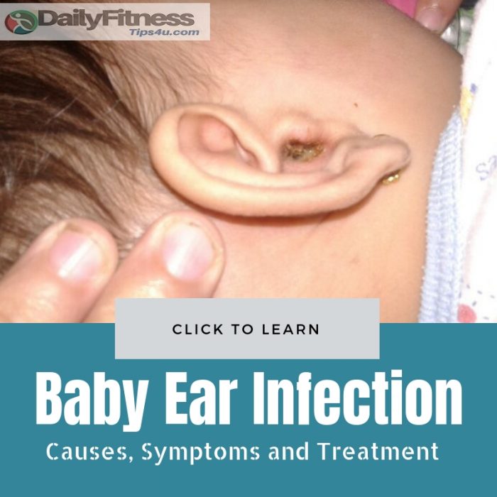 Baby Ear Infection causes treatment
