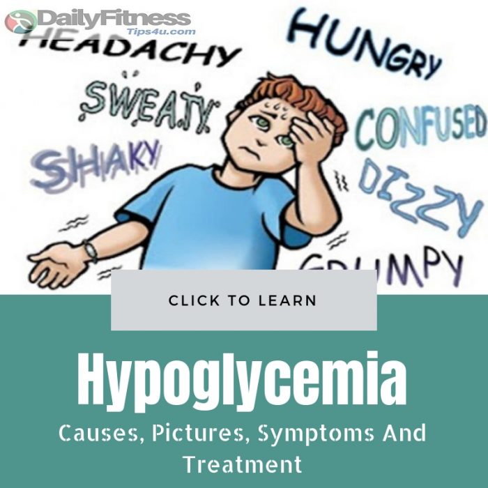 Hypoglycemia Picture