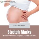 How to Prevent Pregnancy Stretch Marks