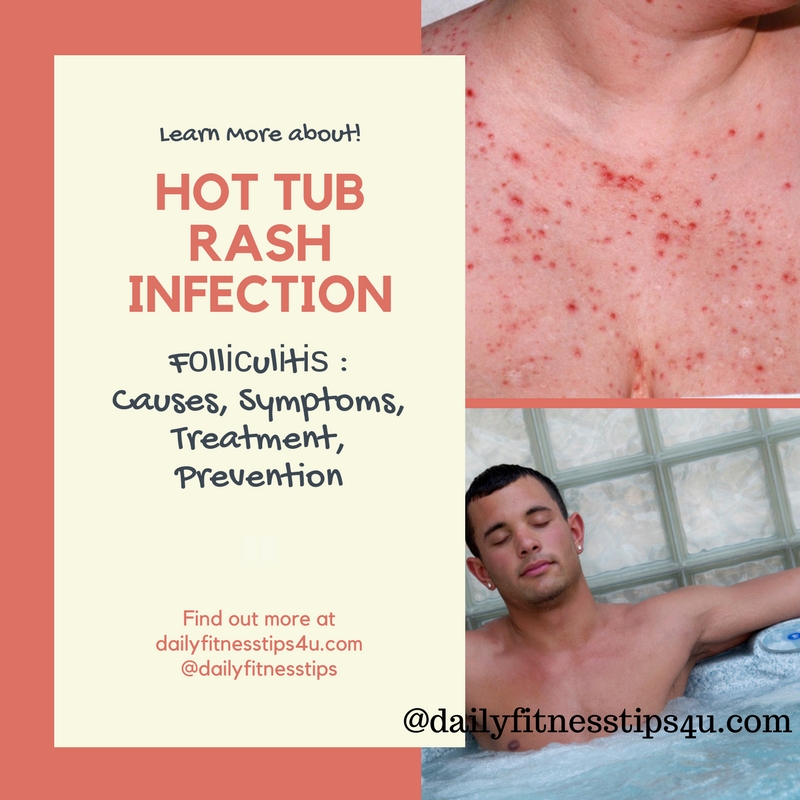 Hot Tub Rash Infection
