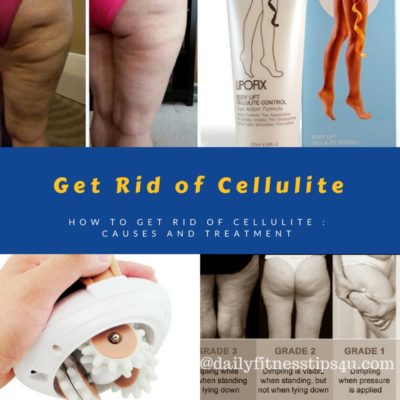 How to Get Rid of Cellulite