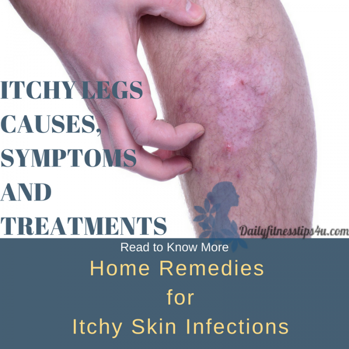 Itchy Skin Causes