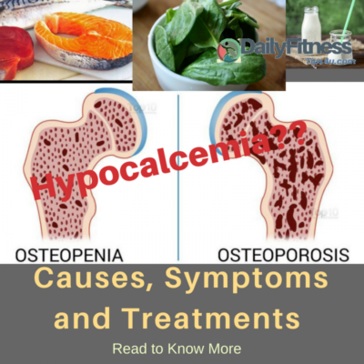 Hypocalcemia