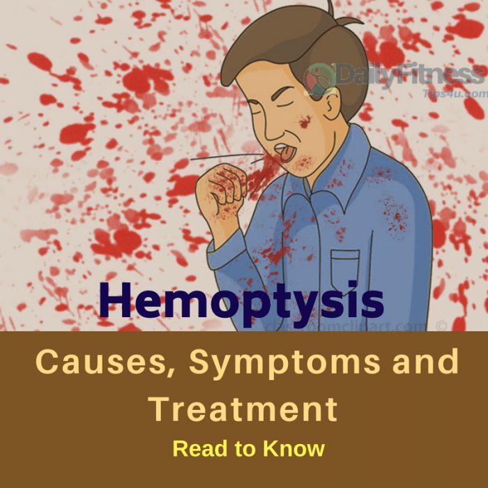 Hemoptysis