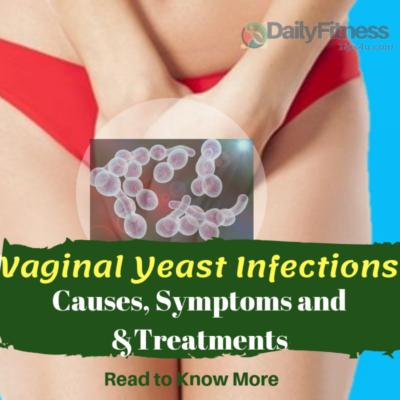 Vaginal Yeast Infections