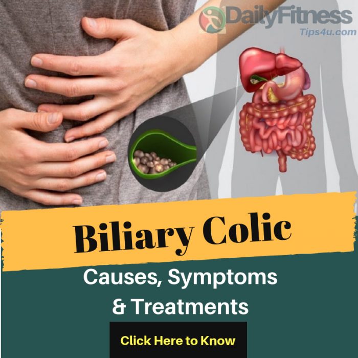 Biliary Colic