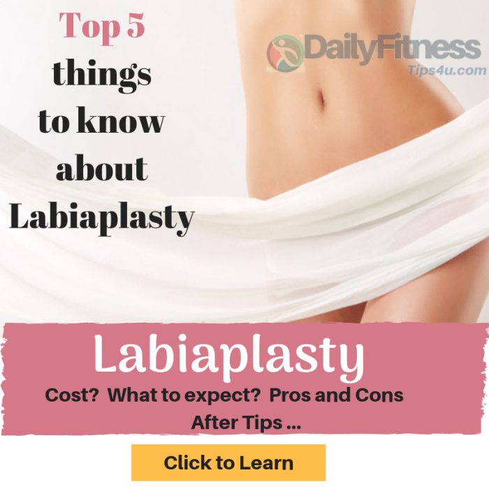 Labiaplasty