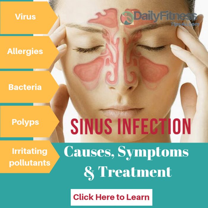 e visit for sinus infection