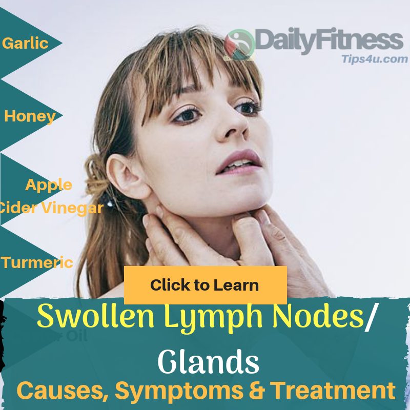 What Causes Swollen Lymph Nodes In Neck