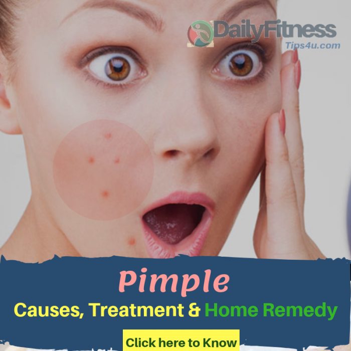 Pimple