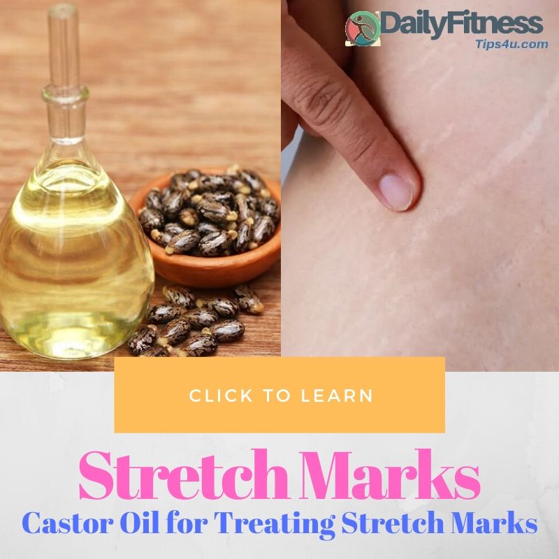 Castor Oil for Treating Stretch Marks