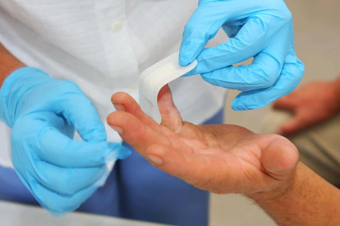 bandage wrapping being applied to finger and hand