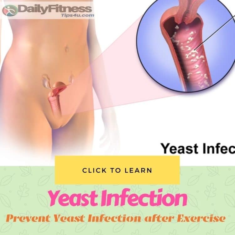 Prevent Yeast Infection after Exercise